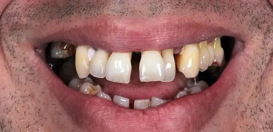 Caso Jairo — antes do tratamento