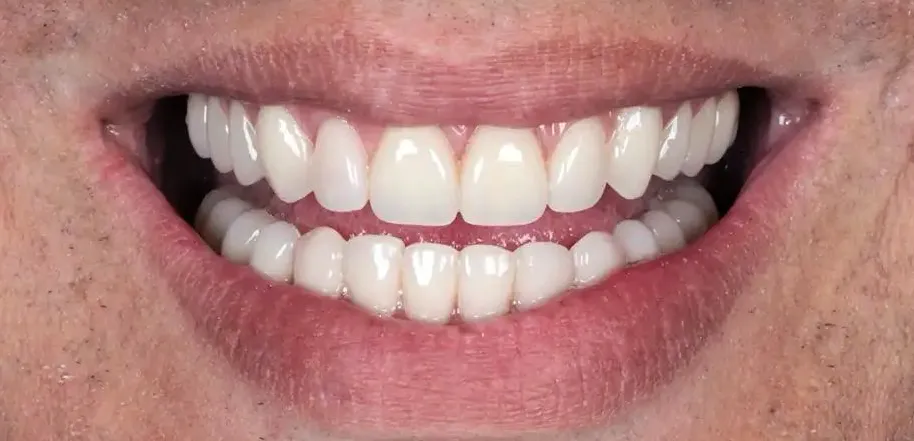 Caso Jairo — depois do tratamento