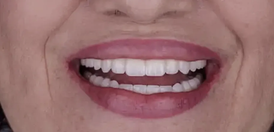 Caso Roberta — depois do tratamento