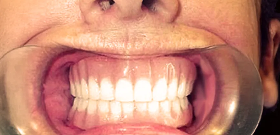 Caso Cláudia — depois do tratamento