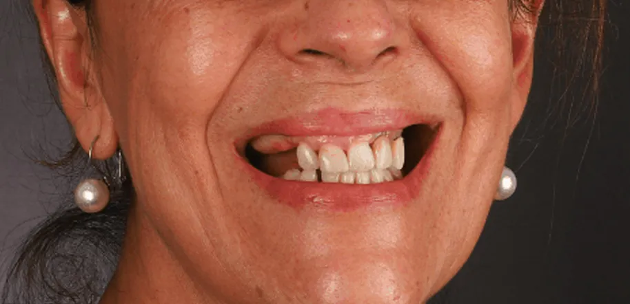 Caso Fernanda — antes do tratamento