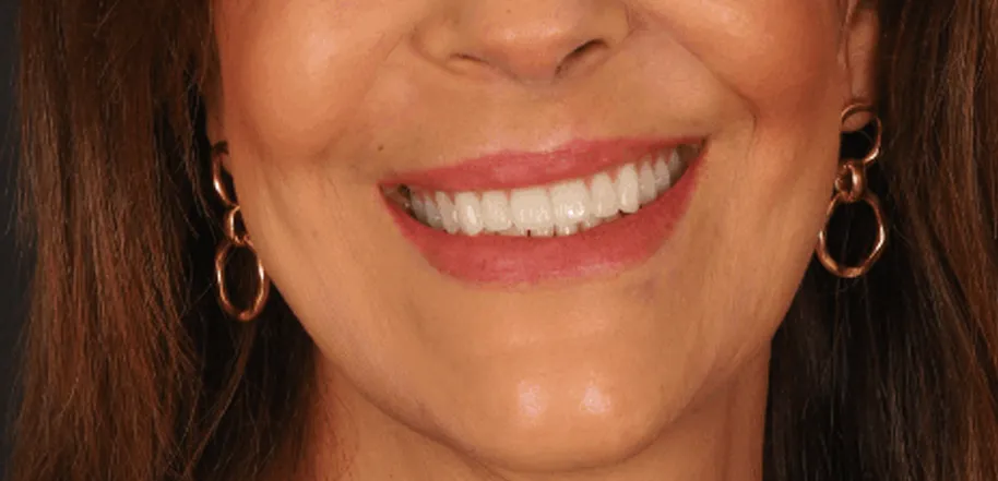 Caso Fernanda — depois do tratamento